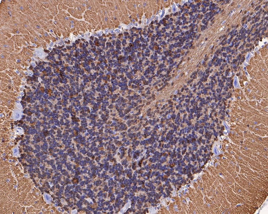 Immunohistochemistry: visinin-like 1 Antibody (PSH0-08) [NBP3-33089] - Immunohistochemical analysis of paraffin-embedded rat cerebellum tissue with Rabbit anti-visinin-like 1 antibody (NBP3-33089) at 1/1,000 dilution. The section was pre-treated using heat mediated antigen retrieval with Tris-EDTA buffer (pH 9.0) for 20 minutes. The tissues were blocked in 1% BSA for 20 minutes at room temperature, washed with ddH2O and PBS, and then probed with the primary antibody (NBP3-33089) at 1/1,000 dilution for 1 hour at room temperature. The detection was performed using an HRP conjugated compact polymer system. DAB was used as the chromogen. Tissues were counterstained with hematoxylin and mounted with DPX.