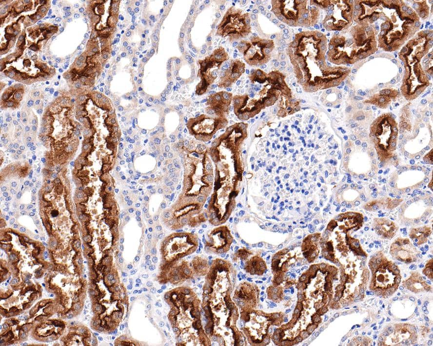 Immunohistochemistry: Villin 1 Antibody (C4) [NBP3-33090] - Immunohistochemical analysis of paraffin-embedded human kidney tissue with Rabbit anti-Villin 1 antibody (NBP3-33090) at 1/3,500 dilution. The section was pre-treated using heat mediated antigen retrieval with Tris-EDTA buffer (pH 9.0) for 20 minutes. The tissues were blocked in 1% BSA for 20 minutes at room temperature, washed with ddH2O and PBS, and then probed with the primary antibody (NBP3-33090) at 1/3,500 dilution for 1 hour at room temperature. The detection was performed using an HRP conjugated compact polymer system. DAB was used as the chromogen. Tissues were counterstained with hematoxylin and mounted with DPX.