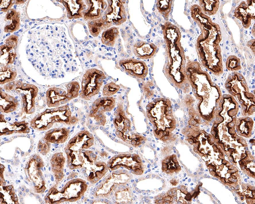 Immunohistochemistry: Villin 1 Antibody (A2) [NBP3-33091] - Immunohistochemical analysis of paraffin-embedded human kidney tissue with Rabbit anti-Villin 1 antibody (NBP3-33091) at 1/3,000 dilution. The section was pre-treated using heat mediated antigen retrieval with Tris-EDTA buffer (pH 9.0) for 20 minutes. The tissues were blocked in 1% BSA for 20 minutes at room temperature, washed with ddH2O and PBS, and then probed with the primary antibody (NBP3-33091) at 1/3,000 dilution for 1 hour at room temperature. The detection was performed using an HRP conjugated compact polymer system. DAB was used as the chromogen. Tissues were counterstained with hematoxylin and mounted with DPX.