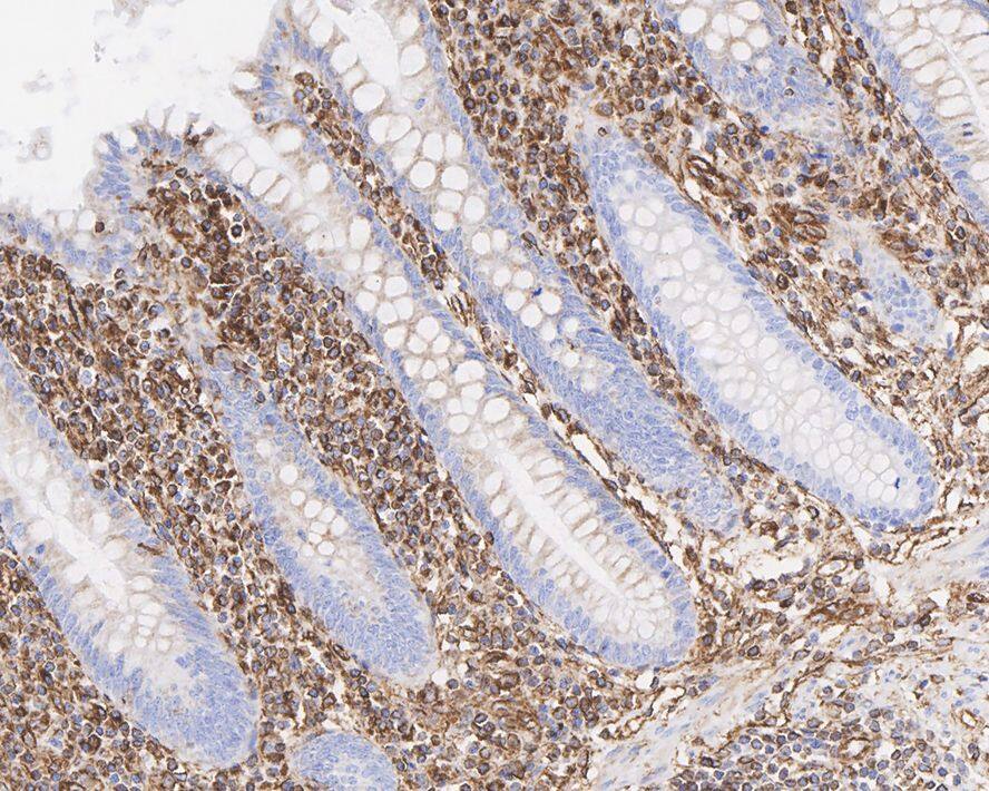 Immunohistochemistry: Vimentin Antibody (A6-C1-R) [NBP3-33092] - Immunohistochemical analysis of paraffin-embedded human appendix tissue with Mouse anti-Vimentin antibody (NBP3-33092) at 1/4,000 dilution. The section was pre-treated using heat mediated antigen retrieval with Tris-EDTA buffer (pH 9.0) for 20 minutes. The tissues were blocked in 1% BSA for 20 minutes at room temperature, washed with ddH2O and PBS, and then probed with the primary antibody (NBP3-33092) at 1/4,000 dilution for 1 hour at room temperature. The detection was performed using an HRP conjugated compact polymer system. DAB was used as the chromogen. Tissues were counterstained with hematoxylin and mounted with DPX.