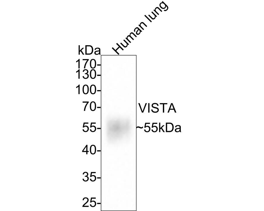 Western Blot: VISTA/B7-H5/PD-1H Antibody (PSH0-65) [NBP3-33095] - Western blot analysis of VISTA/B7-H5/PD-1H on human lung tissue lysates with Rabbit anti-VISTA/B7-H5/PD-1H antibody (NBP3-33095) at 1/1,000 dilution. Lysates/proteins at 40 ug/Lane. Predicted band size: 34 kDa Observed band size: 55 kDa Exposure time: 30 seconds; 10% SDS-PAGE gel. Proteins were transferred to a PVDF membrane and blocked with 5% NFDM/TBST for 1 hour at room temperature. The primary antibody (NBP3-33095) at 1/1,000 dilution was used in 5% NFDM/TBST at room temperature for 2 hours. Goat Anti-Rabbit IgG - HRP Secondary Antibody at 1:100,000 dilution was used for 1 hour at room temperature.