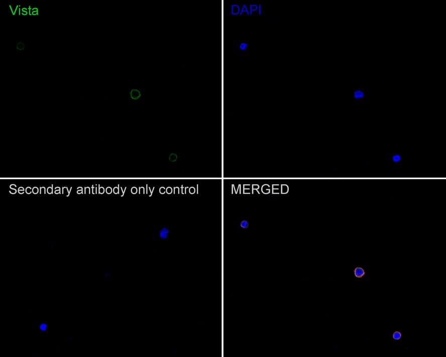 Immunocytochemistry/ Immunofluorescence: VISTA/B7-H5/PD-1H Antibody (PSH0-65) [NBP3-33095] - Immunocytochemistry analysis of PBMC labeling VISTA/B7-H5/PD-1H with Rabbit anti-VISTA/B7-H5/PD-1H antibody (NBP3-33095) at 1/100 dilution. Cells were fixed in 4% paraformaldehyde for 10 minutes at 37 ℃, permeabilized with 0.05% Triton X-100 in PBS for 20 minutes, and then blocked with 2% negative goat serum for 30 minutes at room temperature. Cells were then incubated with Rabbit anti-VISTA/B7-H5/PD-1H antibody (NBP3-33095) at 1/100 dilution in 2% negative goat serum overnight at 4 ℃. Goat Anti-Rabbit IgG H&L (iFluor™ 488) was used as the secondary antibody at 1/1,000 dilution. Nuclear DNA was labelled in blue with DAPI. Beta tubulin (red) was stained at 1/200 dilution overnight at +4℃. Goat Anti-Mouse IgG H&L (iFluor™ 594) was used as the secondary antibody at 1/1,000 dilution.