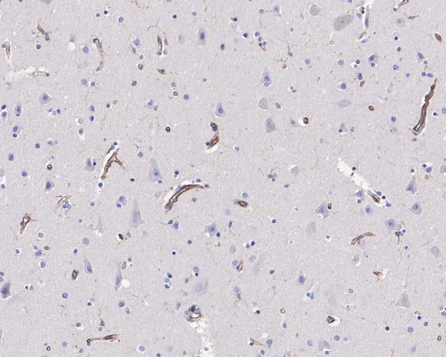 Immunohistochemistry: VISTA/B7-H5/PD-1H Antibody (PSH0-65) [NBP3-33095] - Immunohistochemical analysis of paraffin-embedded human brain tissue with Rabbit anti-VISTA/B7-H5/PD-1H antibody (NBP3-33095) at 1/200 dilution. The section was pre-treated using heat mediated antigen retrieval with Tris-EDTA buffer (pH 9.0) for 20 minutes. The tissues were blocked in 1% BSA for 20 minutes at room temperature, washed with ddH2O and PBS, and then probed with the primary antibody (NBP3-33095) at 1/200 dilution for 1 hour at room temperature. The detection was performed using an HRP conjugated compact polymer system. DAB was used as the chromogen. Tissues were counterstained with hematoxylin and mounted with DPX.