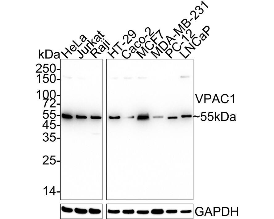 Western Blot VIPR1/VPAC1 Antibody (PD00-96)