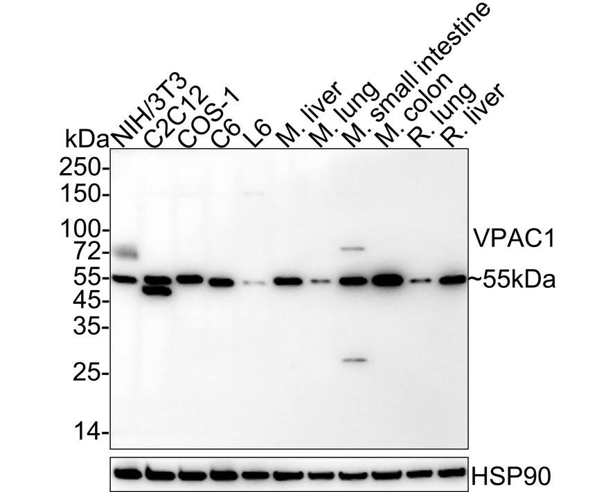 Western Blot VIPR1/VPAC1 Antibody (PD00-96)