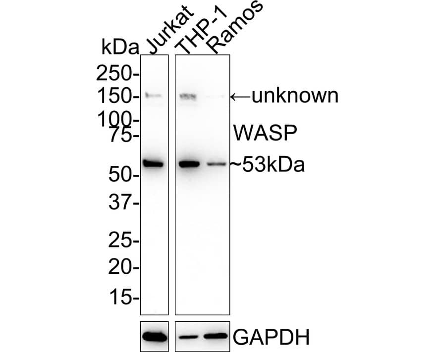 Western Blot: WASP Antibody (JE36-82) [NBP3-33098] - Western blot analysis of WASP on different lysates with Rabbit anti-WASP antibody (NBP3-33098) at 1/1,000 dilution. Lane 1: Jurkat cell lysate Lane 2: THP-1 cell lysate Lane 3: Ramos cell lysate Lysates/proteins at 20 ug/Lane. Predicted band size: 53 kDa Observed band size: 53 kDa Exposure time: 1 minute 2 seconds; 4-20% SDS-PAGE gel. Proteins were transferred to a PVDF membrane and blocked with 5% NFDM/TBST for 1 hour at room temperature. The primary antibody (NBP3-33098) at 1/1,000 dilution was used in 5% NFDM/TBST at 4C overnight. Goat Anti-Rabbit IgG - HRP Secondary Antibody at 1:50,000 dilution was used for 1 hour at room temperature.