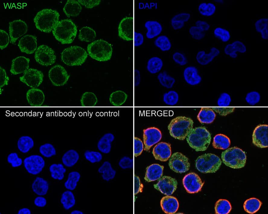 Immunocytochemistry/ Immunofluorescence: WASP Antibody (JE36-82) [NBP3-33098] - Immunocytochemistry analysis of Jurkat cells labeling WASP with Rabbit anti-WASP antibody (NBP3-33098) at 1/100 dilution. Cells were fixed in 4% paraformaldehyde for 20 minutes at room temperature, permeabilized with 0.1% Triton X-100 in PBS for 5 minutes at room temperature, then blocked with 1% BSA in 10% negative goat serum for 1 hour at room temperature. Cells were then incubated with Rabbit anti-WASP antibody (NBP3-33098) at 1/100 dilution in 1% BSA in PBST overnight at 4 ℃. Goat Anti-Rabbit IgG H&L (iFluor™ 488) was used as the secondary antibody at 1/1,000 dilution. PBS instead of the primary antibody was used as the secondary antibody only control. Nuclear DNA was labelled in blue with DAPI. Beta tubulin (red) was stained at 1/100 dilution overnight at +4℃. Goat Anti-Mouse IgG H&L (iFluor™ 594) was used as the secondary antibody at 1/1,000 dilution.