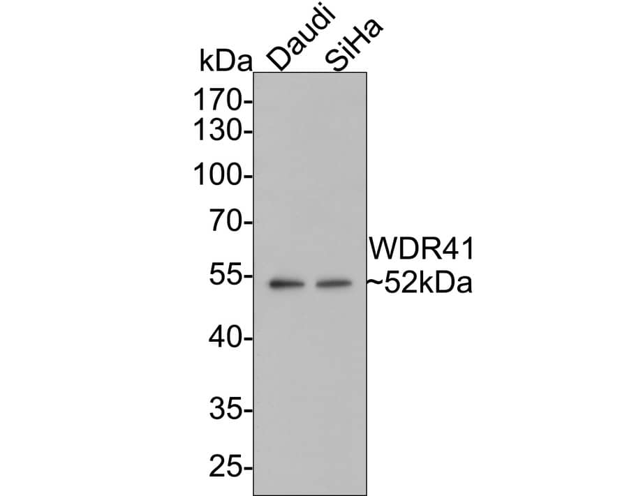 Western blot analysis on different lysates with NBP3-33100 at 1/1,000 dilution. Lane 1: Daudi cell lysate Lane 2: SiHa cell lysate Lysates/proteins at 10 µg/Lane. Predicted band size: 52 kDa Observed band size: 52 kDa Exposure time: 2 minutes; 10% SDS-PAGE gel. Proteins were transferred to a PVDF membrane and blocked with 5% NFDM/TBST for 1 hour at room temperature. NBP3-33100 at 1/1,000 dilution was used in 5% NFDM/TBST at room temperature for 2 hours. Goat anti-Mouse IgG [HRP] at 1:150,000 dilution was used for 1 hour at room temperature.