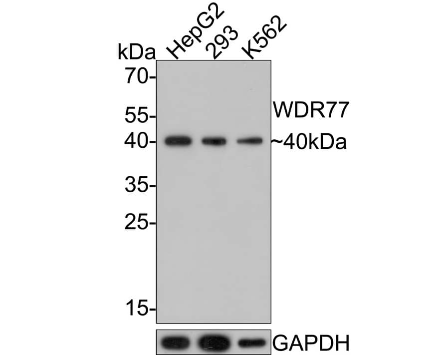 Western Blot: WDR77 Antibody (PSH0-07) [NBP3-33101] - Western blot analysis of WDR77 on different lysates with Rabbit anti-WDR77 antibody (NBP3-33101) at 1/1,000 dilution. Lane 1: HepG2 cell lysate Lane 2: 293 cell lysate Lane 3: K562 cell lysate Lysates/proteins at 10 ug/Lane. Predicted band size: 37 kDa Observed band size: 40 kDa Exposure time: 2 minutes; 12% SDS-PAGE gel. Proteins were transferred to a PVDF membrane and blocked with 5% NFDM/TBST for 1 hour at room temperature. The primary antibody (NBP3-33101) at 1/1,000 dilution was used in 5% NFDM/TBST at room temperature for 2 hours. Goat Anti-Rabbit IgG - HRP Secondary Antibody at 1:300,000 dilution was used for 1 hour at room temperature.