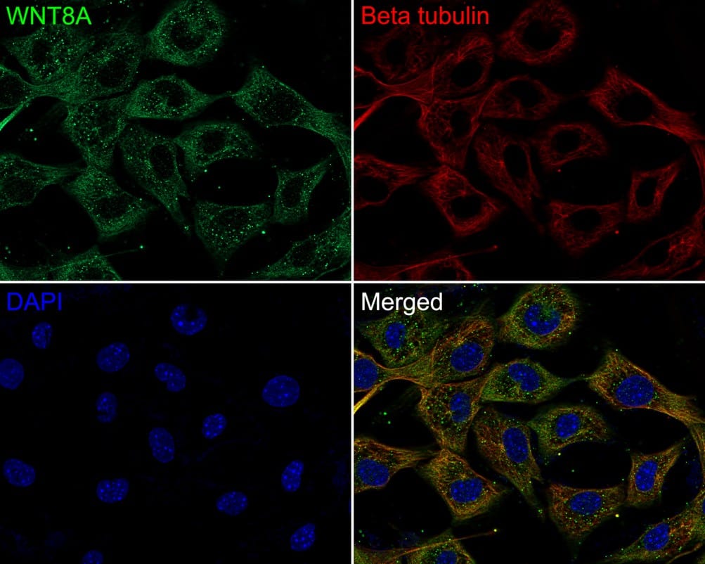 Immunocytochemistry/ Immunofluorescence: Wnt-8a Antibody (PSH0-39) [NBP3-33103] - Immunocytochemistry analysis of NIH/3T3 cells labeling Wnt-8a with Rabbit anti-Wnt-8a antibody (NBP3-33103) at 1/50 dilution. Cells were fixed in 4% paraformaldehyde for 10 minutes at 37 ℃, permeabilized with 0.05% Triton X-100 in PBS for 20 minutes, and then blocked with 2% negative goat serum for 30 minutes at room temperature. Cells were then incubated with Rabbit anti-Wnt-8a antibody (NBP3-33103) at 1/50 dilution in 2% negative goat serum overnight at 4 ℃. Goat Anti-Rabbit IgG H&L (iFluor™ 488) was used as the secondary antibody at 1/1,000 dilution. Nuclear DNA was labelled in blue with DAPI. Beta tubulin (red) was stained at 1/100 dilution overnight at +4℃. Goat Anti-Mouse IgG H&L (iFluor™ 594) was used as the secondary antibody at 1/1,000 dilution.