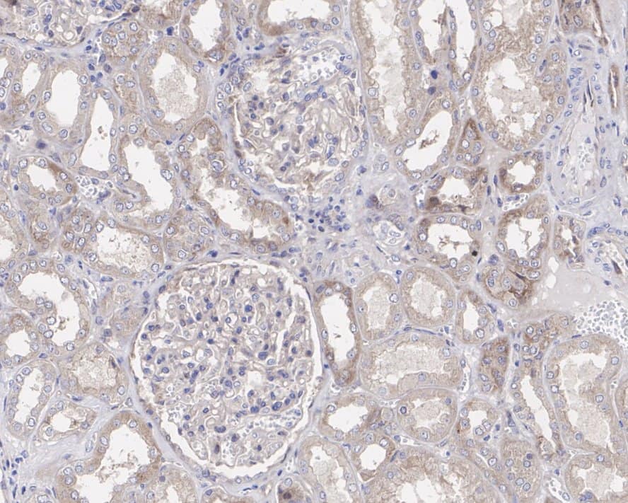 Immunohistochemistry: Yes Antibody (JE37-26) [NBP3-33107] - Immunohistochemical analysis of paraffin-embedded human kidney tissue with Rabbit anti-Yes antibody (NBP3-33107) at 1/200 dilution. The section was pre-treated using heat mediated antigen retrieval with Tris-EDTA buffer (pH 9.0) for 20 minutes. The tissues were blocked in 1% BSA for 20 minutes at room temperature, washed with ddH2O and PBS, and then probed with the primary antibody (NBP3-33107) at 1/200 dilution for 1 hour at room temperature. The detection was performed using an HRP conjugated compact polymer system. DAB was used as the chromogen. Tissues were counterstained with hematoxylin and mounted with DPX.