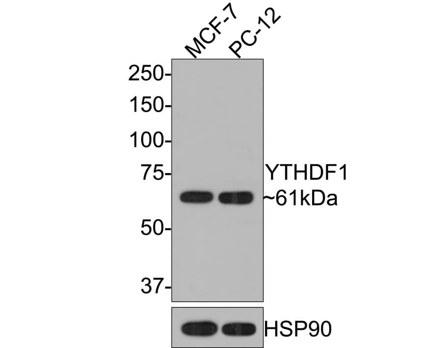Western Blot YTHD1 Antibody