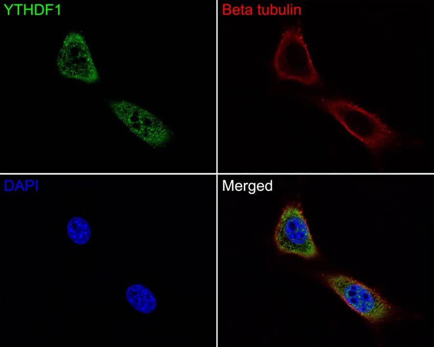 Immunocytochemistry/ Immunofluorescence: YTHD1 Antibody [NBP3-33108] - Immunocytochemistry analysis of NIH/3T3 cells labeling YTHD1 with Rabbit anti-YTHD1 antibody (NBP3-33108) at 1/100 dilution. Cells were fixed in 4% paraformaldehyde for 10 minutes at 37 ℃, permeabilized with 0.05% Triton X-100 in PBS for 20 minutes, and then blocked with 2% negative goat serum for 30 minutes at room temperature. Cells were then incubated with Rabbit anti-YTHD1 antibody (NBP3-33108) at 1/100 dilution in 2% negative goat serum overnight at 4 ℃. Goat Anti-Rabbit IgG H&L (iFluor™ 488) was used as the secondary antibody at 1/1,000 dilution. Nuclear DNA was labelled in blue with DAPI. Beta tubulin (red) was stained at 1/200 dilution overnight at +4℃. Goat Anti-Mouse IgG H&L (iFluor™ 647) were used as the secondary antibody at 1/1,000 dilution.