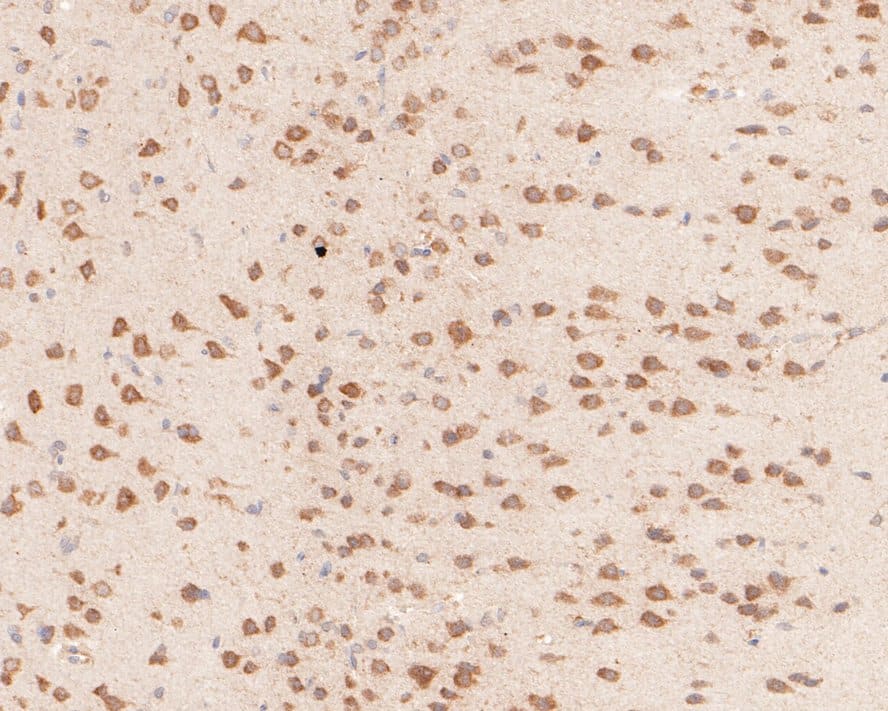Immunohistochemistry: YTHD1 Antibody [NBP3-33108] - Immunohistochemical analysis of paraffin-embedded rat brain tissue with Rabbit anti-YTHD1 antibody (NBP3-33108) at 1/2,000 dilution. The section was pre-treated using heat mediated antigen retrieval with Tris-EDTA buffer (pH 9.0) for 20 minutes. The tissues were blocked in 1% BSA for 20 minutes at room temperature, washed with ddH2O and PBS, and then probed with the primary antibody (NBP3-33108) at 1/2,000 dilution for 1 hour at room temperature. The detection was performed using an HRP conjugated compact polymer system. DAB was used as the chromogen. Tissues were counterstained with hematoxylin and mounted with DPX.