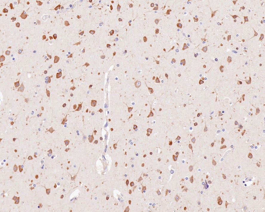Immunohistochemistry: YTHD1 Antibody (PSH0-23) [NBP3-33109] - Immunohistochemical analysis of paraffin-embedded human brain tissue with Rabbit anti-YTHD1 antibody (NBP3-33109) at 1/1,000 dilution. The section was pre-treated using heat mediated antigen retrieval with Tris-EDTA buffer (pH 9.0) for 20 minutes. The tissues were blocked in 1% BSA for 20 minutes at room temperature, washed with ddH2O and PBS, and then probed with the primary antibody (NBP3-33109) at 1/1,000 dilution for 1 hour at room temperature. The detection was performed using an HRP conjugated compact polymer system. DAB was used as the chromogen. Tissues were counterstained with hematoxylin and mounted with DPX.