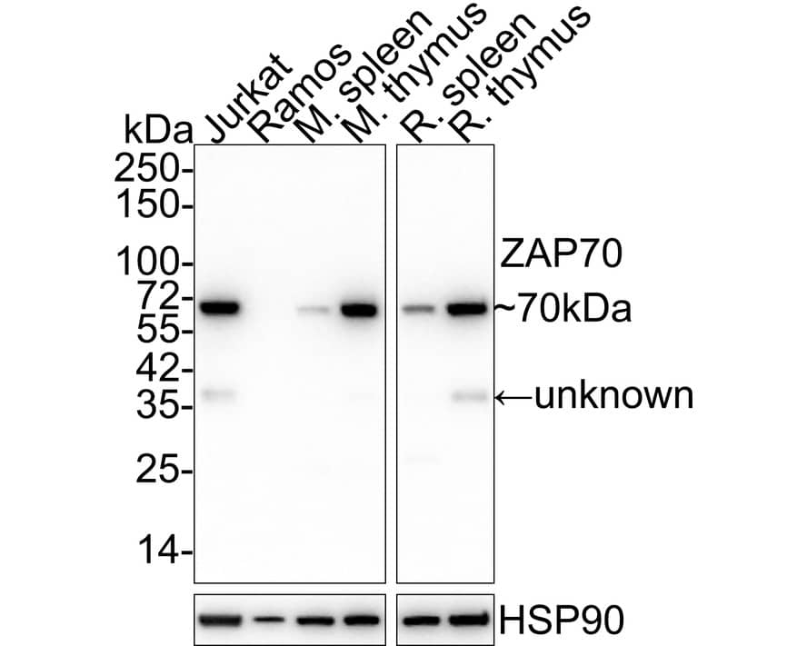 Western Blot: ZAP70 Antibody (A1B5-R) [NBP3-33110] - Western blot analysis of ZAP70 on different lysates with Mouse anti-ZAP70 antibody (NBP3-33110) at 1/1,000 dilution. Lane 1: Jurkat cell lysate Lane 2: Ramos cell lysate (negative) Lane 3: Mouse spleen tissue lysate Lane 4: Mouse thymus tissue lysate Lane 5: Rat spleen tissue lysate Lane 6: Rat thymus tissue lysate Lysates/proteins at 20 ug/Lane. Predicted band size: 70 kDa Observed band size: 70 kDa Exposure time: 1 minute 21 seconds; 4-20% SDS-PAGE gel. Proteins were transferred to a PVDF membrane and blocked with 5% NFDM/TBST for 1 hour at room temperature. The primary antibody (NBP3-33110) at 1/1,000 dilution was used in 5% NFDM/TBST at 4C overnight. Goat Anti-Mouse IgG - HRP Secondary Antibody at 1/50,000 dilution was used for 1 hour at room temperature.