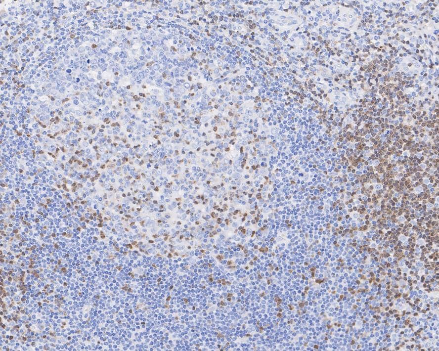 Immunohistochemistry: ZAP70 Antibody (A1B5-R) [NBP3-33110] - Immunohistochemical analysis of paraffin-embedded human tonsil tissue with Mouse anti-ZAP70 antibody (NBP3-33110) at 1/2,000 dilution. The section was pre-treated using heat mediated antigen retrieval with Tris-EDTA buffer (pH 9.0) for 20 minutes. The tissues were blocked in 1% BSA for 20 minutes at room temperature, washed with ddH2O and PBS, and then probed with the primary antibody (NBP3-33110) at 1/2,000 dilution for 1 hour at room temperature. The detection was performed using an HRP conjugated compact polymer system. DAB was used as the chromogen. Tissues were counterstained with hematoxylin and mounted with DPX.