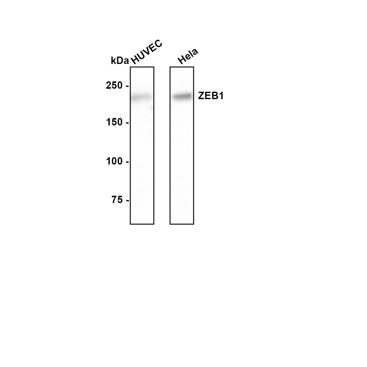 Western blot analysis on different lysates with NBP3-33111 at 1/500 dilution. Lane 1: HUVEC cell lysate Lane 2: Hela cell lysate Lysates/proteins at 10 µg/Lane. Predicted band size: 124 kDa Observed band size: 200 kDa Exposure time: 3 minutes; 6% SDS-PAGE gel. Proteins were transferred to a PVDF membrane and blocked with 5% NFDM/TBST for 1 hour at room temperature. NBP3-33111 at 1/500 dilution was used in 5% NFDM/TBST at room temperature for 2 hours. Goat Anti-Rabbit IgG [HRP] Secondary Antibody at 1:200,000 dilution was used for 1 hour at room temperature.