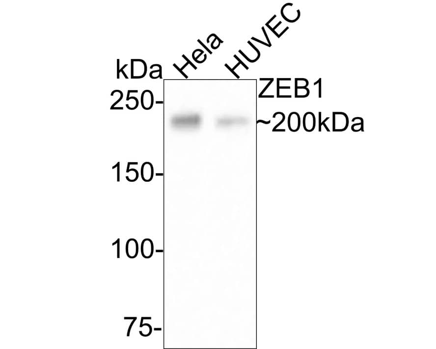 Western Blot: ZEB1 Antibody (JE57-64) [NBP3-33111] - Western blot analysis of ZEB1 on different lysates with Rabbit anti-ZEB1 antibody (NBP3-33111) at 1/500 dilution. Lane 1: Hela cell lysate Lane 2: HUVEC cell lysate Lysates/proteins at 10 ug/Lane. Predicted band size: 124 kDa Observed band size: 200 kDa Exposure time: 3 minutes; 6% SDS-PAGE gel. Proteins were transferred to a PVDF membrane and blocked with 5% NFDM/TBST for 1 hour at room temperature. The primary antibody (NBP3-33111) at 1/500 dilution was used in 5% NFDM/TBST at room temperature for 2 hours. Goat Anti-Rabbit IgG - HRP Secondary Antibody at 1:200,000 dilution was used for 1 hour at room temperature.