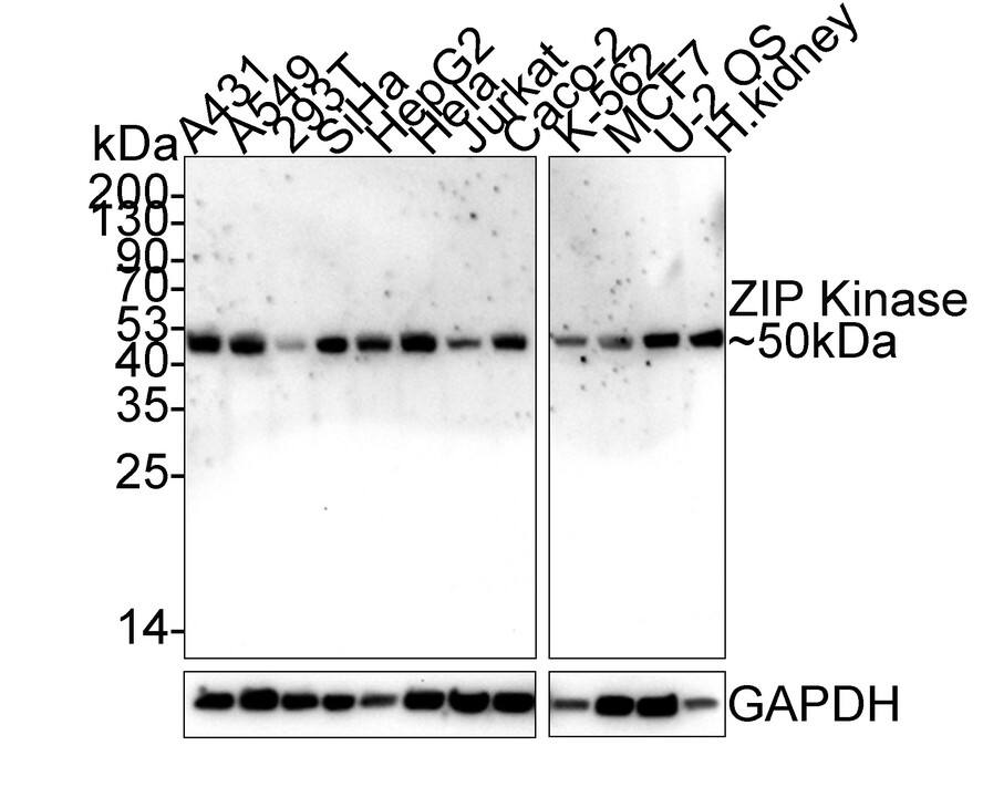 Western Blot: DAPK3/ZIPK Antibody (PSH02-18) [NBP3-33113] - Western blot analysis of DAPK3/ZIPK on different lysates with Rabbit anti-DAPK3/ZIPK antibody (NBP3-33113) at 1/1,000 dilution. Lane 1: A431 cell lysate Lane 2: A549 cell lysate Lane 3: 293T cell lysate Lane 4: SiHa cell lysate Lane 5: HepG2 cell lysate Lane 6: Hela cell lysate Lane 7: Jurkat cell lysate Lane 8: Caco-2 cell lysate Lane 9: K-562 cell lysate Lane 10: MCF7 cell lysate Lane 11: U-2 OS cell lysate Lane 12: Human kidney tissue lysate Lysates/proteins at 40 ug/Lane. Predicted band size: 53 kDa Observed band size: 50 kDa Exposure time: 5 minutes; 4-20% SDS-PAGE gel. Proteins were transferred to a PVDF membrane and blocked with 5% NFDM/TBST for 1 hour at room temperature. The primary antibody (NBP3-33113) at 1/1,000 dilution was used in 5% NFDM/TBST at 4C overnight. Goat Anti-Rabbit IgG - HRP Secondary Antibody at 1/50,000 dilution was used for 1 hour at room temperature.