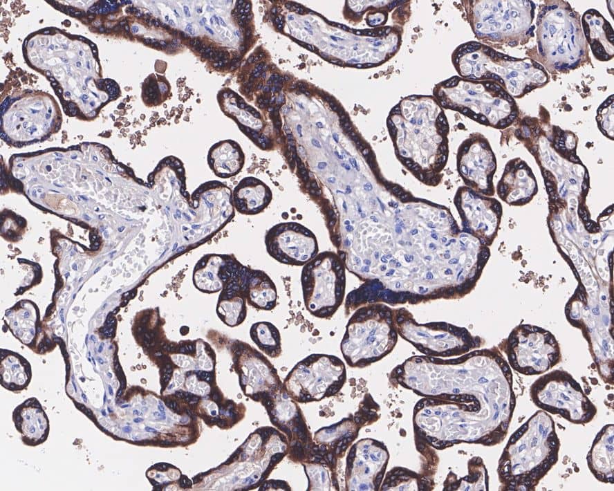 Immunohistochemistry: Chorionic Gonadotropin beta Chain (hCG beta) Antibody (JE45-04) [NBP3-33129] - Immunohistochemical analysis of paraffin-embedded human placenta tissue with Rabbit anti-Chorionic Gonadotropin beta Chain (hCG beta) antibody (NBP3-33129) at 1/1,000 dilution. The section was pre-treated using heat mediated antigen retrieval with Tris-EDTA buffer (pH 9.0) for 20 minutes. The tissues were blocked in 1% BSA for 20 minutes at room temperature, washed with ddH2O and PBS, and then probed with the primary antibody (NBP3-33129) at 1/1,000 dilution for 1 hour at room temperature. The detection was performed using an HRP conjugated compact polymer system. DAB was used as the chromogen. Tissues were counterstained with hematoxylin and mounted with DPX.