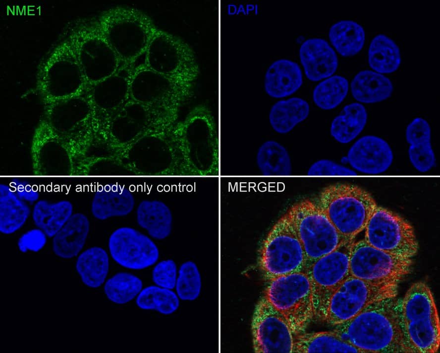 Immunocytochemistry/ Immunofluorescence: NM23-H1 Antibody (13C1-R) [NBP3-33131] - Immunocytochemistry analysis of MCF7 cells labeling NM23-H1 with Mouse anti-NM23-H1 antibody (NBP3-33131) at 1/100 dilution. Cells were fixed in 4% paraformaldehyde for 20 minutes at room temperature, permeabilized with 0.1% Triton X-100 in PBS for 5 minutes at room temperature, then blocked with 1% BSA in 10% negative goat serum for 1 hour at room temperature. Cells were then incubated with Mouse anti-NM23-H1 antibody (NBP3-33131) at 1/100 dilution in 1% BSA in PBST overnight at 4 ℃. Goat Anti-Mouse IgG H&L (iFluor™ 488) was used as the secondary antibody at 1/1,000 dilution. PBS instead of the primary antibody was used as the secondary antibody only control. Nuclear DNA was labelled in blue with DAPI. beta Tubulin (red) was stained at 1/100 dilution overnight at +4℃. Goat Anti-Rabbit IgG H&L (iFluor™ 594) were used as the secondary antibody at 1/1,000 dilution.