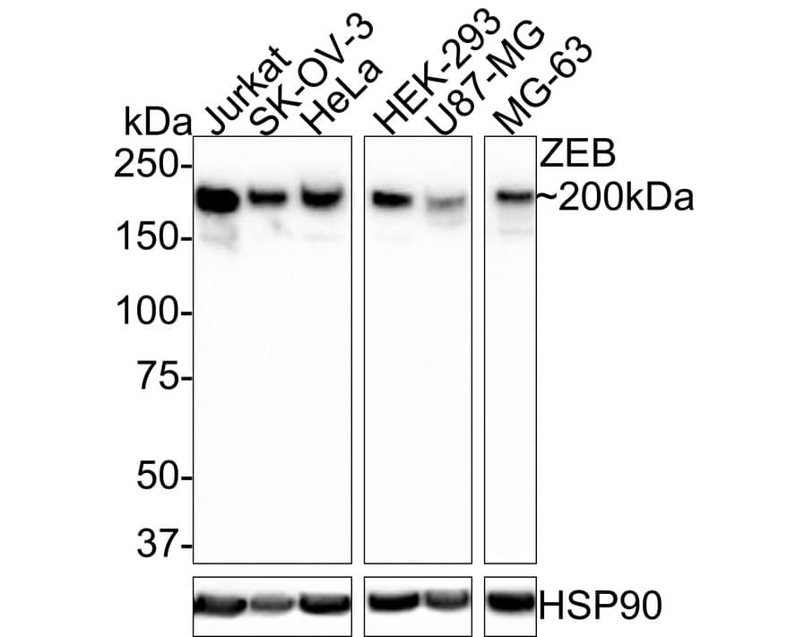 Western Blot: ZEB1 Antibody (PSH0-61) [NBP3-33133] - Western blot analysis of ZEB1 on different lysates with Rabbit anti-ZEB1 antibody (NBP3-33133) at 1/1,000 dilution. Lane 1: Jurkat cell lysate Lane 2: SK-OV-3 cell lysate Lane 3: HeLa cell lysate Lane 4: HEK-293 cell lysate Lane 5: U87-MG cell lysate Lane 6: MG-63 cell lysate Lysates/proteins at 30 ug/Lane. Predicted band size: 124 kDa Observed band size: 200 kDa Exposure time: 2 minutes; 8% SDS-PAGE gel. Proteins were transferred to a PVDF membrane and blocked with 5% NFDM/TBST for 1 hour at room temperature. The primary antibody (NBP3-33133) at 1/1,000 dilution was used in 5% NFDM/TBST at room temperature for 2 hours. Goat Anti-Rabbit IgG - HRP Secondary Antibody at 1:200,000 dilution was used for 1 hour at room temperature.
