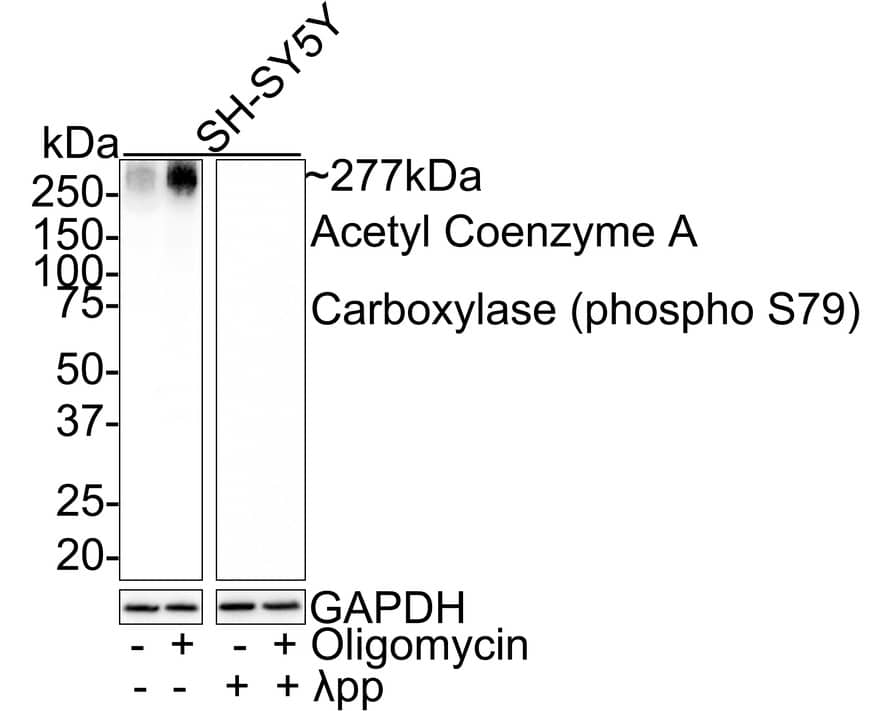 Western Blot: Acetyl-CoA Carboxylase alpha/ACACA [p Ser79] Antibody (JE55-54) [NBP3-33134] - Western blot analysis of Acetyl-CoA Carboxylase alpha/ACACA on different lysates with Rabbit anti-Acetyl-CoA Carboxylase alpha/ACACA antibody (NBP3-33134) at 1/1,000 dilution. Lane 1: SH-SY5Y whole cell lysate Lane 2: SH-SY5Y treated with 0.5uM Oligomycin for 30 minutes whole cell lysate Lane 3: SH-SY5Y treated with  pp for 1 hour whole cell lysate Lane 4: SH-SY5Y treated with 0.5uM Oligomycin for 30 minutes then treated with  pp for 1 hour whole cell lysate Lysates/proteins at 20 ug/Lane. Predicted band size: 277 kDa Observed band size: 277 kDa Exposure time: 1 minute; 4-20% SDS-PAGE gel. Proteins were transferred to a PVDF membrane and blocked with 5% NFDM/TBST for 1 hour at room temperature. The primary antibody (NBP3-33134) at 1/1,000 dilution was used in 5% NFDM/TBST at room temperature for 2 hours. Goat Anti-Rabbit IgG - HRP Secondary Antibody at 1:100,000 dilution was used for 1 hour at room temperature.