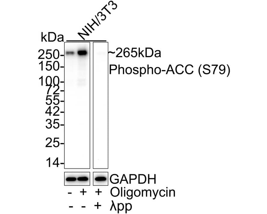 Western Blot: Acetyl-CoA Carboxylase alpha/ACACA [p Ser79] Antibody (JE63-95) [NBP3-33135] - Western blot analysis of Acetyl-CoA Carboxylase alpha/ACACA on different lysates with Rabbit anti-Acetyl-CoA Carboxylase alpha/ACACA antibody (NBP3-33135) at 1/2,000 dilution. Lane 1: NIH/3T3 cell lysate Lane 2: NIH/3T3 treated with 0.5uM Oligomycin for 30 minutes cell lysate Lane 3: NIH/3T3 treated with 0.5uM Oligomycin for 30 minutes then treated with  pp for 1 hour cell lysate Lysates/proteins at 20 ug/Lane. Predicted band size: 265 kDa Observed band size: 265 kDa Exposure time: 1 minutes 14 seconds; 4-20% SDS-PAGE gel. Proteins were transferred to a PVDF membrane and blocked with 5% NFDM/TBST for 1 hour at room temperature. The primary antibody (NBP3-33135) at 1/2,000 dilution was used in 5% NFDM/TBST at 4C overnight. Goat Anti-Rabbit IgG - HRP Secondary Antibody at 1/50,000 dilution was used for 1 hour at room temperature.