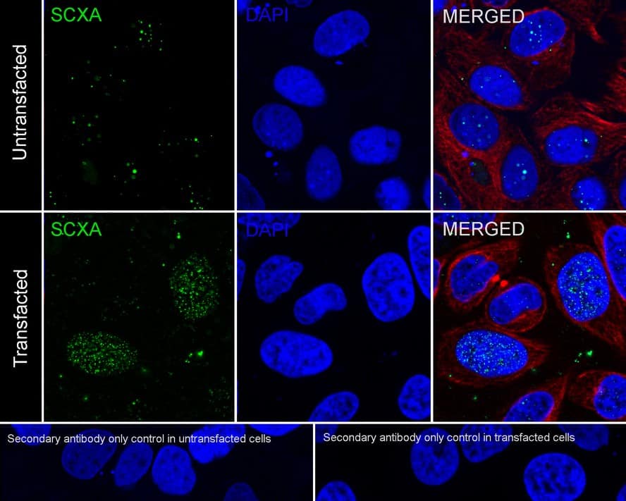 Immunocytochemistry/ Immunofluorescence: SCX Antibody (PSH02-25) [NBP3-33137] - Immunocytochemistry analysis of HeLa transfected with or without SCX cells labeling SCXA with Rabbit anti-SCX antibody (NBP3-33137) at 1/100 dilution. Cells were fixed in 4% paraformaldehyde for 20 minutes at room temperature, permeabilized with 0.1% Triton X-100 in PBS for 5 minutes at room temperature, then blocked with 1% BSA in 10% negative goat serum for 1 hour at room temperature. Cells were then incubated with Rabbit anti-SCX antibody (NBP3-33137) at 1/100 dilution in 1% BSA in PBST overnight at 4 ℃. Goat Anti-Rabbit IgG H&L (iFluor™ 488) was used as the secondary antibody at 1/1,000 dilution. PBS instead of the primary antibody was used as the secondary antibody only control. Nuclear DNA was labelled in blue with DAPI. Beta tubulin (red) was stained at 1/100 dilution overnight at +4℃. Goat Anti-Mouse IgG H&L (iFluor™ 594) was used as the secondary antibody at 1/1,000 dilution.