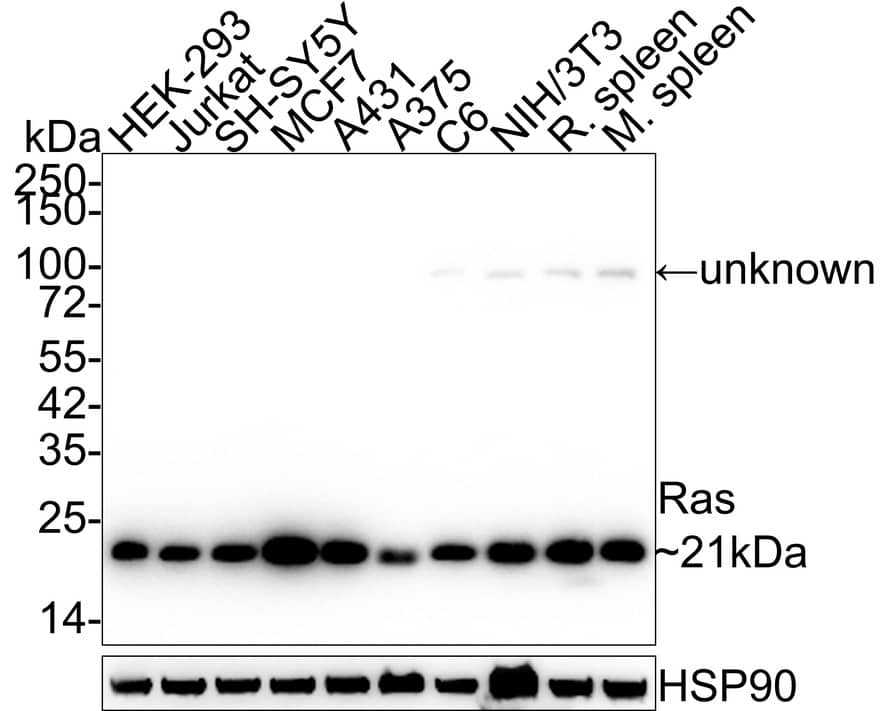 Western blot analysis on different lysates with NBP3-33138 at 1/1,000 dilution. Lane 1: HEK-293 cell lysate (20 µg/Lane) Lane 2: Jurkat cell lysate (20 µg/Lane) Lane 3: SH-SY5Y cell lysate (20 µg/Lane) Lane 4: MCF7 cell lysate (20 µg/Lane) Lane 5: A431 cell lysate (20 µg/Lane) Lane 6: A375 cell lysate (20 µg/Lane) Lane 7: C6 cell lysate (20 µg/Lane) Lane 8: NIH/3T3 cell lysate (20 µg/Lane) Lane 9: Rat spleen tissue lysate (40 µg/Lane) Lane 10: Mouse spleen tissue lysate (40 µg/Lane) Predicted band size: 21 kDa Observed band size: 21 kDa Exposure time: 25 seconds; 4-20% SDS-PAGE gel. Proteins were transferred to a PVDF membrane and blocked with 5% NFDM/TBST for 1 hour at room temperature. NBP3-33138 at 1/1,000 dilution was used in 5% NFDM/TBST at 4℃ overnight. Goat Anti-Rabbit IgG [HRP] Secondary Antibody at 1/50,000 dilution was used for 1 hour at room temperature.