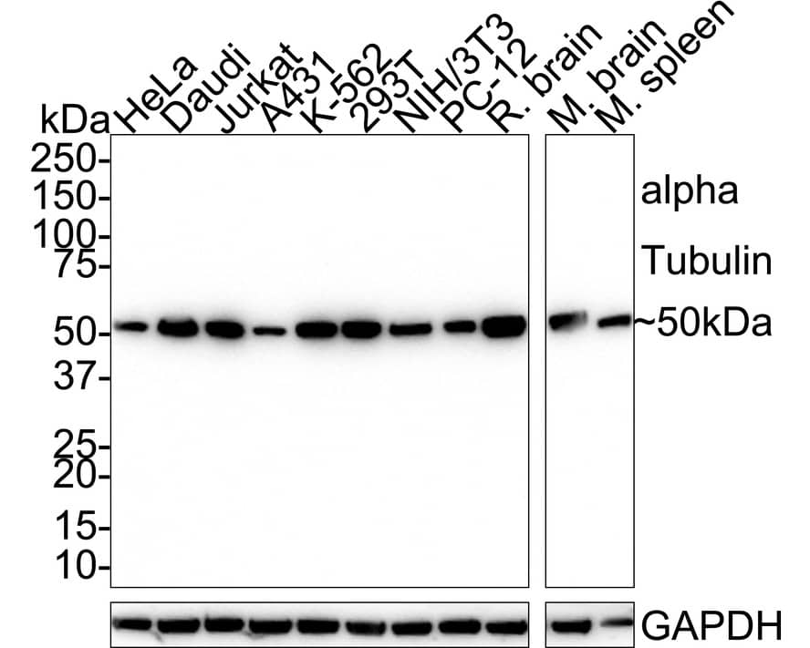 Western blot analysis on different lysates with NBP3-33140 at 1/5,000 dilution. Lane 1: HeLa cell lysate (20 µg/Lane) Lane 2: Daudi cell lysate (20 µg/Lane) Lane 3: Jurkat cell lysate (20 µg/Lane) Lane 4: A431 cell lysate (20 µg/Lane) Lane 5: K-562 cell lysate (20 µg/Lane) Lane 6: 293T cell lysate (20 µg/Lane) Lane 7: NIH/3T3 cell lysate (20 µg/Lane) Lane 8: PC-12 cell lysate (20 µg/Lane) Lane 9: Rat brain tissue lysate (40 µg/Lane) Lane 10: Mouse brain tissue lysate (40 µg/Lane) Lane 11: Mouse spleen tissue lysate (40 µg/Lane) Predicted band size: 50 kDa Observed band size: 50 kDa Exposure time: 3 minutes;  4-20% SDS-PAGE gel. Proteins were transferred to a PVDF membrane and blocked with 5% NFDM/TBST for 1 hour at room temperature. NBP3-33140 at 1/5,000 dilution was used in 5% NFDM/TBST at 4℃ overnight. Goat Anti-Rabbit IgG [HRP] Secondary Antibody at 1/50,000 dilution was used for 1 hour at room temperature.