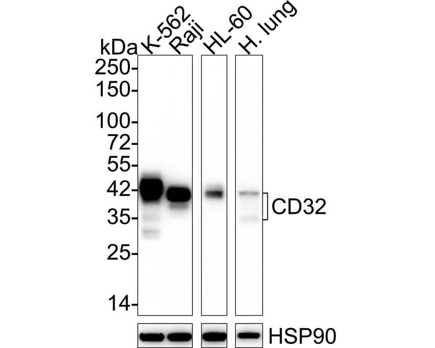 Western blot analysis on different lysates with NBP3-33141 at 1/1,000 dilution. Lane 1: K-562 cell lysate (20 µg/Lane) Lane 2: Raji cell lysate (20 µg/Lane) Lane 3: HL-60 cell lysate (20 µg/Lane) Lane 4: Human lung tissue lysate (30 µg/Lane) Predicted band size: 35 kDa Observed band size: 35-40 kDa Exposure time: 3 minutes;  4-20% SDS-PAGE gel. Proteins were transferred to a PVDF membrane and blocked with 5% NFDM/TBST for 1 hour at room temperature. NBP3-33141 at 1/1,000 dilution was used in 5% NFDM/TBST at 4℃ overnight. Goat Anti-Rabbit IgG [HRP] Secondary Antibody at 1/50,000 dilution was used for 1 hour at room temperature.