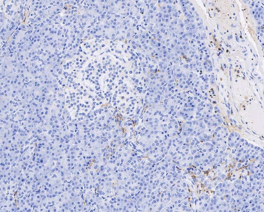 Immunohistochemistry: Fc gamma RIIA/CD32a Antibody (JE64-17) [NBP3-33141] - Immunohistochemical analysis of paraffin-embedded human pancreas tissue with Rabbit anti-Fc gamma RIIA/CD32a antibody (NBP3-33141) at 1/2,000 dilution. The section was pre-treated using heat mediated antigen retrieval with Tris-EDTA buffer (pH 9.0) for 20 minutes. The tissues were blocked in 1% BSA for 20 minutes at room temperature, washed with ddH2O and PBS, and then probed with the primary antibody (NBP3-33141) at 1/2,000 dilution for 1 hour at room temperature. The detection was performed using an HRP conjugated compact polymer system. DAB was used as the chromogen. Tissues were counterstained with hematoxylin and mounted with DPX.