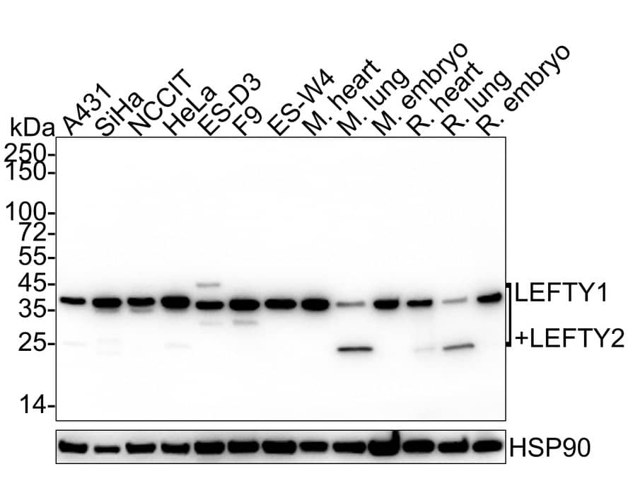 Western Blot: Lefty1/2 Antibody (JE38-88) [NBP3-33142] - Western blot analysis of Lefty1/2 on different lysates with Rabbit anti-Lefty1/2 antibody (NBP3-33142) at 1/1,000 dilution. Lane 1: A431 cell lysate (15 ug/Lane) Lane 2: SiHa cell lysate (15 ug/Lane) Lane 3: NCCIT cell lysate (15 ug/Lane) Lane 4: HeLa cell lysate (15 ug/Lane) Lane 5: ES-D3 cell lysate (15 ug/Lane) Lane 6: F9 cell lysate (15 ug/Lane) Lane 7: ES-W4 cell lysate (15 ug/Lane) Lane 8: Mouse heart tissue lysate (30 ug/Lane) Lane 9: Mouse lung tissue lysate (30 ug/Lane) Lane 10: Mouse embryo tissue lysate (30 ug/Lane) Lane 11: Rat heart tissue lysate (30 ug/Lane) Lane 12: Rat lung tissue lysate (30 ug/Lane) Lane 13: Rat embryo tissue lysate (30 ug/Lane) Predicted band size: 41 kDa Observed band size: 28-41 kDa Exposure time: 1 minute ECL; 4-20% SDS-PAGE gel. Proteins were transferred to a PVDF membrane and blocked with 5% NFDM/TBST for 1 hour at room temperature. The primary antibody (NBP3-33142) at 1/1,000 dilution was used in 5% NFDM/TBST at 4C overnight. Goat Anti-Rabbit IgG - HRP Secondary Antibody at 1/50,000 dilution was used for 1 hour at room temperature.