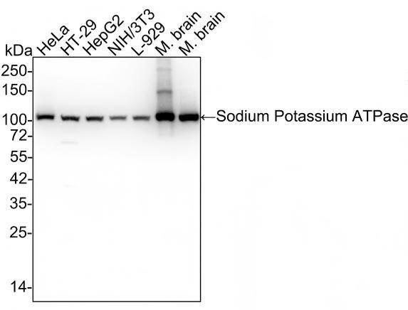 Western blot analysis on different lysates with NBP3-33143 at 1/100,000 dilution and competitor's antibody at 1/100,000 dilution. Lane 1: HeLa cell lysate (no heat) (20 µg/Lane) Lane 2: HT-29 cell lysate (no heat) (20 µg/Lane) Lane 3: HepG2 cell lysate (no heat) (20 µg/Lane) Lane 4: NIH/3T3 cell lysate (no heat) (20 µg/Lane) Lane 5: L-929 cell lysate (no heat) (20 µg/Lane) Lane 6: Mouse brain tissue lysate (no heat) (20 µg/Lane) Lane 7: Rat brain tissue lysate (no heat) (20 µg/Lane) Notice: no heat means the lysate is not boiled. Predicted band size: 113 kDa Observed band size: 100 kDa Exposure time: 20 seconds;  4-20% SDS-PAGE gel. Proteins were transferred to a PVDF membrane and blocked with 5% NFDM/TBST for 1 hour at room temperature. NBP3-33143 at 1/100,000 dilution and competitor's antibody at 1/100,000 dilution were used in 5% NFDM/TBST at 4℃ overnight. Goat Anti-Rabbit IgG [HRP] Secondary Antibody at 1/50,000 dilution was used for 1 hour at room temperature.