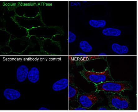 Immunocytochemistry/ Immunofluorescence: Sodium Potassium ATPase Alpha 1 Antibody (ST0533) [NBP3-33143] - Immunocytochemistry analysis of HeLa cells labeling Sodium Potassium ATPase Alpha 1 with Rabbit anti-Sodium Potassium ATPase Alpha 1 Alpha 1 antibody (NBP3-33143) at 1/500 dilution. Cells were fixed in 100% precooled methanol for 5 minutes at room temperature, then blocked with 1% BSA in 10% negative goat serum for 1 hour at room temperature. Cells were then incubated with Rabbit anti-Sodium Potassium ATPase antibody at 1/500 dilution in 1% BSA in PBST overnight at 4 ℃. Goat Anti-Rabbit IgG H&L (iFluor™ 488) was used as the secondary antibody at 1/1,000 dilution. PBS instead of the primary antibody was used as the secondary antibody only control. Nuclear DNA was labelled in blue with DAPI. Beta tubulin (red) was stained at 1/100 dilution overnight at +4℃. Goat Anti-Mouse IgG H&L (iFluor™ 594) was used as the secondary antibody at 1/1,000 dilution.