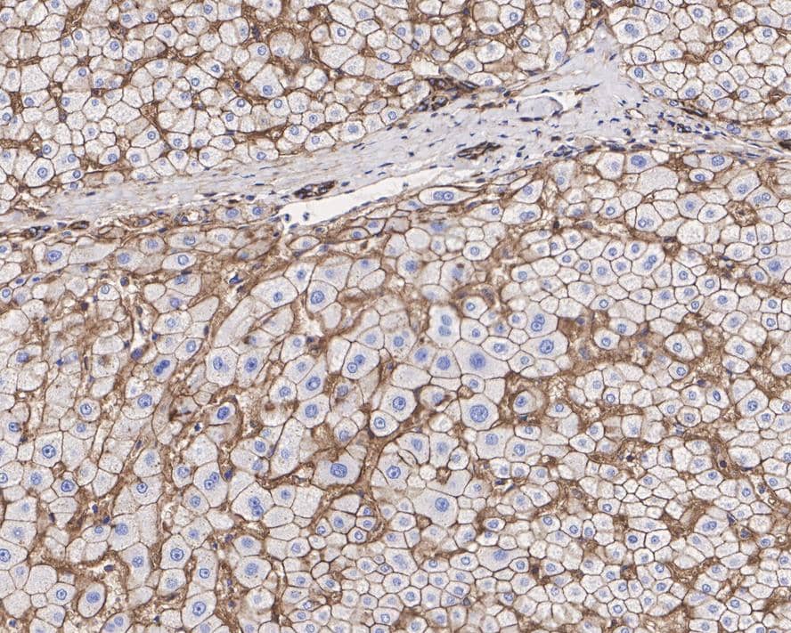 Immunohistochemistry: Sodium Potassium ATPase Alpha 1 Antibody (ST0533) [NBP3-33143] - Immunohistochemical analysis of paraffin-embedded human liver tissue with Rabbit anti-Sodium Potassium ATPase Alpha 1 antibody (NBP3-33143) at 1/2,000 dilution. The section was pre-treated using heat mediated antigen retrieval with Tris-EDTA buffer (pH 9.0) for 20 minutes. The tissues were blocked in 1% BSA for 20 minutes at room temperature, washed with ddH2O and PBS, and then probed with the primary antibody (NBP3-33143) at 1/2,000 dilution for 1 hour at room temperature. The detection was performed using an HRP conjugated compact polymer system. DAB was used as the chromogen. Tissues were counterstained with hematoxylin and mounted with DPX.