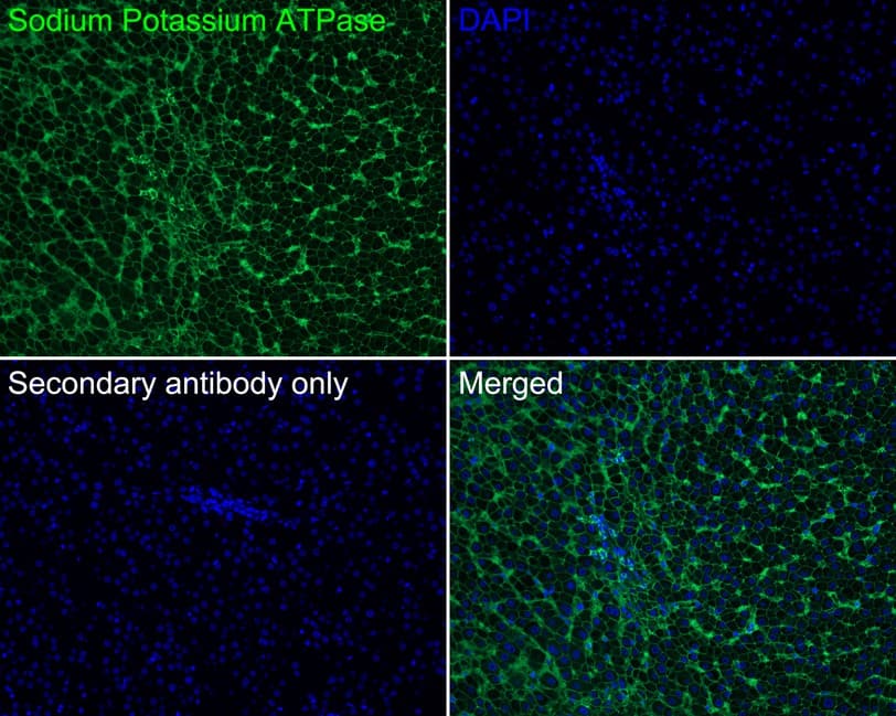 Immunohistochemistry: Sodium Potassium ATPase Alpha 1 Antibody (ST0533) [NBP3-33143] - Immunofluorescence analysis of paraffin-embedded human liver tissue labeling Sodium Potassium ATPase Alpha 1 with Rabbit anti-Sodium Potassium ATPase Alpha 1 antibody (NBP3-33143) at 1/200 dilution. The section was pre-treated using heat mediated antigen retrieval with Tris-EDTA buffer (pH 9.0) for 20 minutes. The tissues were blocked in 10% negative goat serum for 1 hour at room temperature, washed with PBS, and then probed with the primary antibody (NBP3-33143, green) at 1/200 dilution overnight at 4 ℃, washed with PBS. Goat Anti-Rabbit IgG H&L (iFluor™ 488) was used as the secondary antibody at 1/1,000 dilution. Nuclei were counterstained with DAPI (blue).