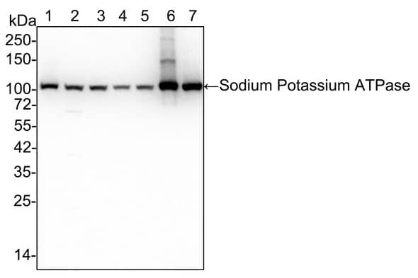 Western Blot: Sodium Potassium ATPase Alpha 1 Antibody (ST0533) [NBP3-33143] - Western blot analysis of Sodium Potassium ATPase Alpha 1 on different lysates with Rabbit anti-Sodium Potassium ATPase Alpha 1 antibody (NBP3-33143) at 1/100,000 dilution. Lane 1: HeLa cell lysate (no heat) (20 µg/Lane) Lane 2: HT-29 cell lysate (no heat) (20 µg/Lane) Lane 3: HepG2 cell lysate (no heat) (20 µg/Lane) Lane 4: NIH/3T3 cell lysate (no heat) (20 µg/Lane) Lane 5: L-929 cell lysate (no heat) (20 µg/Lane) Lane 6: Mouse brain tissue lysate (no heat) (20 µg/Lane) Lane 7: Rat brain tissue lysate (no heat) (20 µg/Lane) Predicted band size: 113 kDa Observed band size: 100 kDa Exposure time: 20 seconds; 4-20% SDS-PAGE gel. Proteins were transferred to a PVDF membrane and blocked with 5% NFDM/TBST for 1 hour at room temperature. The primary antibody at 1/100,000 dilution was used in 5% NFDM/TBST at 4℃ overnight. Goat Anti-Rabbit IgG - HRP Secondary Antibody at 1:50,000 dilution was used for 1 hour at room temperature.