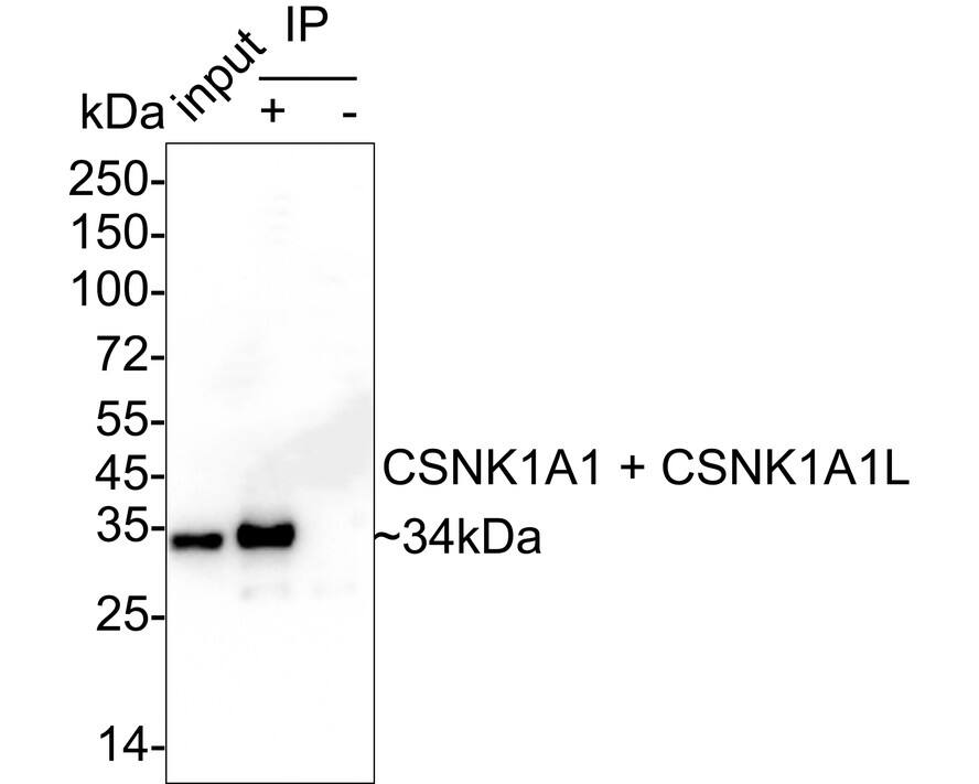 Immunoprecipitation: CSNK1A1/CSNK1A1L Antibody (PSH04-58) [NBP3-33146] - CSNK1A1/CSNK1A1L was immunoprecipitated from 0.2 mg HeLa cell lysate with NBP3-33146 at 2 ug/25 ul agarose. Western blot was performed from the immunoprecipitate using NBP3-33146 at 1/1,000 dilution. Anti-Rabbit IgG for IP Nano-secondary antibody at 1/5,000 dilution was used for 1 hour at room temperature. Lane 1: HeLa cell lysate (input) Lane 2: NBP3-33146 IP in HeLa cell lysate Lane 3: Rabbit IgG instead of NBP3-33146 in HeLa cell lysate Blocking/Dilution buffer: 5% NFDM/TBST Exposure time: 1 minute 11 seconds; ECL