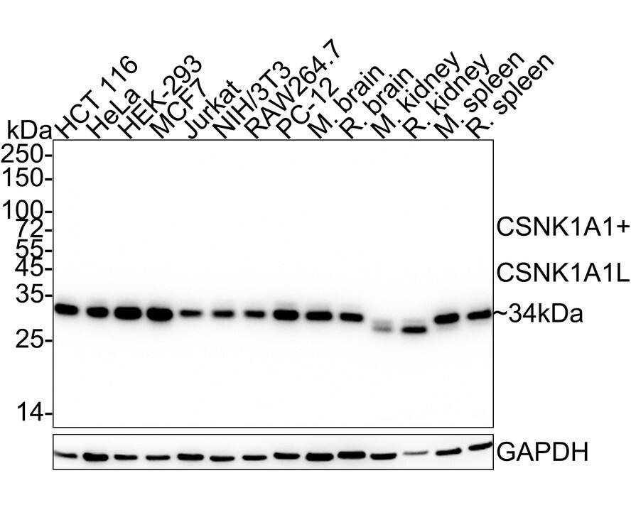 Western Blot: CSNK1A1/CSNK1A1L Antibody (PSH04-58) [NBP3-33146] - Western blot analysis of CSNK1A1/CSNK1A1L on different lysates with Rabbit anti-CSNK1A1/CSNK1A1L antibody (NBP3-33146) at 1/2,000 dilution. Lane 1: HCT 116 cell lysate (20 ug/Lane) Lane 2: HeLa cell lysate (20 ug/Lane) Lane 3: HEK-293 cell lysate (20 ug/Lane) Lane 4: MCF7 cell lysate (20 ug/Lane) Lane 5: Jurkat cell lysate (20 ug/Lane) Lane 6: NIH/3T3 cell lysate (20 ug/Lane) Lane 7: RAW264.7 cell lysate (20 ug/Lane) Lane 8: PC-12 cell lysate (20 ug/Lane) Lane 9: Mouse brain tissue lysate (40 ug/Lane) Lane 10: Rat brain tissue lysate (40 ug/Lane) Lane 11: Mouse kidney tissue lysate (40 ug/Lane) Lane 12: Rat kidney tissue lysate (40 ug/Lane) Lane 13: Mouse spleen tissue lysate (40 ug/Lane) Lane 14: Rat spleen tissue lysate (40 ug/Lane) Predicted band size: 39  kDa Observed band size: 34 kDa Exposure time: 15 seconds; ECL; 4-20% SDS-PAGE gel. Proteins were transferred to a PVDF membrane and blocked with 5% NFDM/TBST for 1 hour at room temperature. The primary antibody (NBP3-33146) at 1/2,000 dilution was used in 5% NFDM/TBST at 4C overnight. Goat Anti-Rabbit IgG - HRP Secondary Antibody at 1/50,000 dilution was used for 1 hour at room temperature.