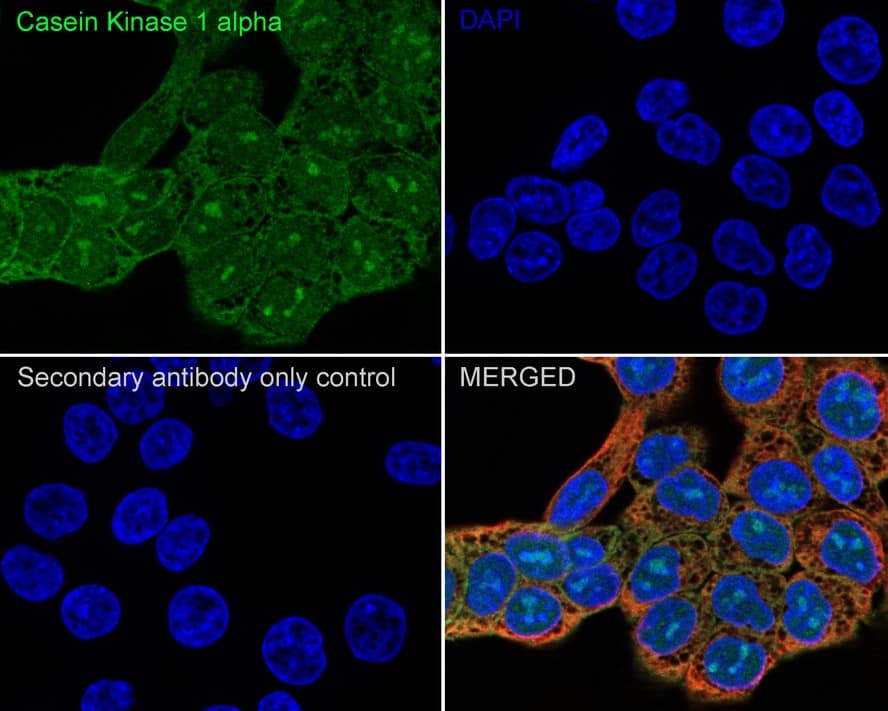 Immunocytochemistry/ Immunofluorescence: CSNK1A1/CSNK1A1L Antibody (PSH04-58) [NBP3-33146] - Immunocytochemistry analysis of HCT 116 cells labeling CSNK1A1/CSNK1A1L with Rabbit anti-CSNK1A1/CSNK1A1L antibody (NBP3-33146) at 1/500 dilution. Cells were fixed in 4% paraformaldehyde for 20 minutes at room temperature, permeabilized with 0.1% Triton X-100 in PBS for 5 minutes at room temperature, then blocked with 1% BSA in 10% negative goat serum for 1 hour at room temperature. Cells were then incubated with Rabbit anti-CSNK1A1/CSNK1A1L antibody (NBP3-33146) at 1/500 dilution in 1% BSA in PBST overnight at 4 ℃. Goat Anti-Rabbit IgG H&L (iFluor™ 488) was used as the secondary antibody at 1/1,000 dilution. PBS instead of the primary antibody was used as the secondary antibody only control. Nuclear DNA was labelled in blue with DAPI. Beta tubulin (red) was stained at 1/100 dilution overnight at +4℃. Goat Anti-Mouse IgG H&L (iFluor™ 594) was used as the secondary antibody at 1/1,000 dilution.
