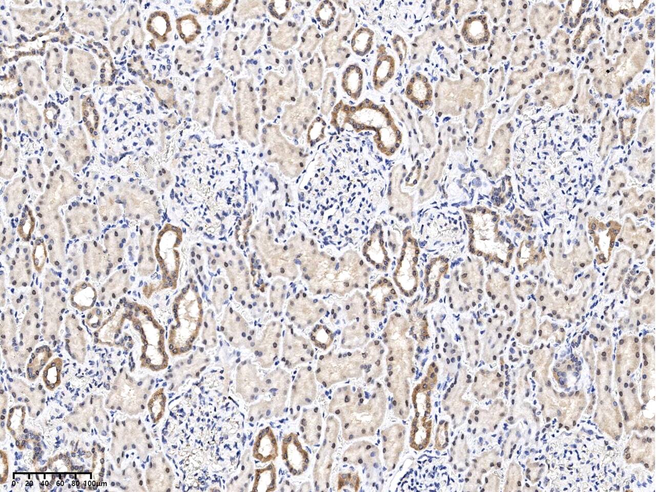 Immunohistochemistry-Paraffin: Testican 1/Testican 1/SPOCK1 Antibody [NBP3-33162] - Immunochemical staining of human Testican 1/SPOCK1 in human kidney with NBP3-33162 at 1:500 dilution, formalin-fixed paraffin embedded sections.