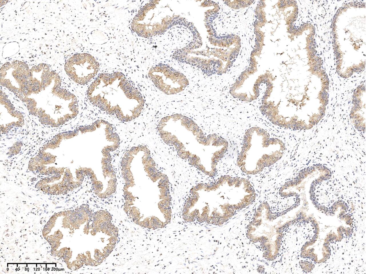 Immunohistochemistry-Paraffin: Testican 1/Testican 1/SPOCK1 Antibody [NBP3-33162] - Immunochemical staining of human Testican 1/SPOCK1 in human prostate with NBP3-33162 at 1:500 dilution, formalin-fixed paraffin embedded sections.