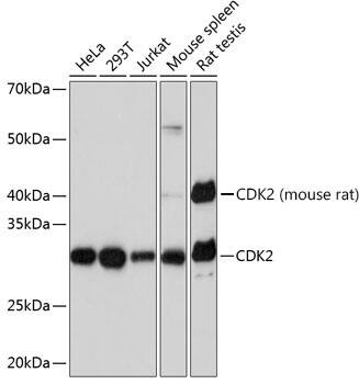 Western Blot: CDK2 Antibody (10E0N5) [NBP3-33184] - Western blot analysis of various lysates using CDK2 Rabbit mAb at 1:1000 dilution.Secondary antibody: HRP-conjugated Goat anti-Rabbit IgG (H+L) at 1:10000 dilution.Lysates/proteins: 25ug per lane.Blocking buffer: 3% nonfat dry milk in TBST.Detection: ECL Basic Kit.Exposure time: 10s.