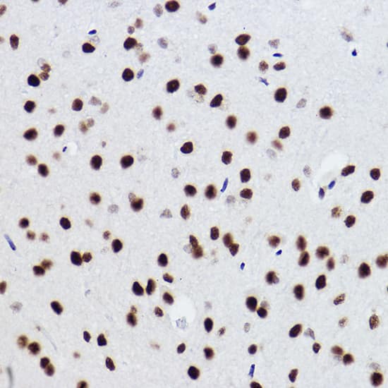 Immunohistochemistry BRMS1 Antibody (5Y8J3)