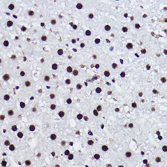 Immunohistochemistry: BRMS1 Antibody (5Y8J3) [NBP3-33186] - Immunohistochemistry analysis of paraffin-embedded Rat liver using BRMS1 Rabbit mAb at dilution of 1:100 (40x lens). High pressure antigen retrieval performed with 0.01M Citrate Bufferr (pH 6.0) prior to IHC staining.