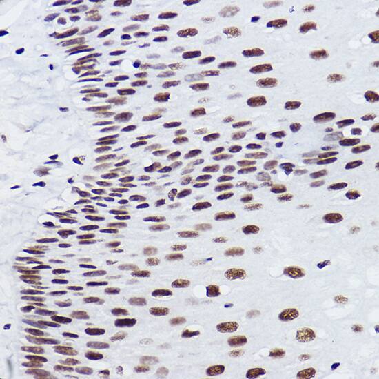 Immunohistochemistry: BRMS1 Antibody (5Y8J3) [NBP3-33186] - Immunohistochemistry analysis of paraffin-embedded Human esophageal using BRMS1 Rabbit mAb at dilution of 1:100 (40x lens). High pressure antigen retrieval performed with 0.01M Citrate Bufferr (pH 6.0) prior to IHC staining.