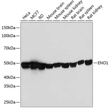 Western Blot: Enolase 1 Antibody (9E5R2) [NBP3-33187] - Western blot analysis of various lysates using Enolase 1 Rabbit mAb at 1:1000 dilution.Secondary antibody: HRP-conjugated Goat anti-Rabbit IgG (H+L) at 1:10000 dilution.Lysates/proteins: 25ug per lane.Blocking buffer: 3% nonfat dry milk in TBST.Detection: ECL Basic Kit.Exposure time: 3s.